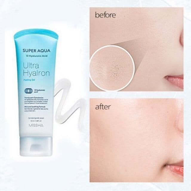 Gel exfoliant MISSHA Super Aqua Ultra Hyalron